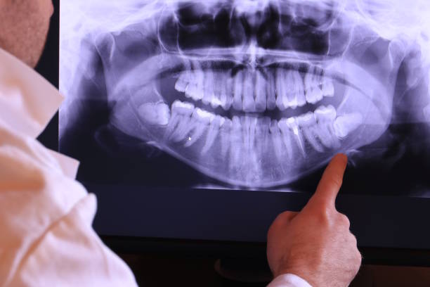 Best Dentist for Tooth Abscess  in Forest Hills, MI