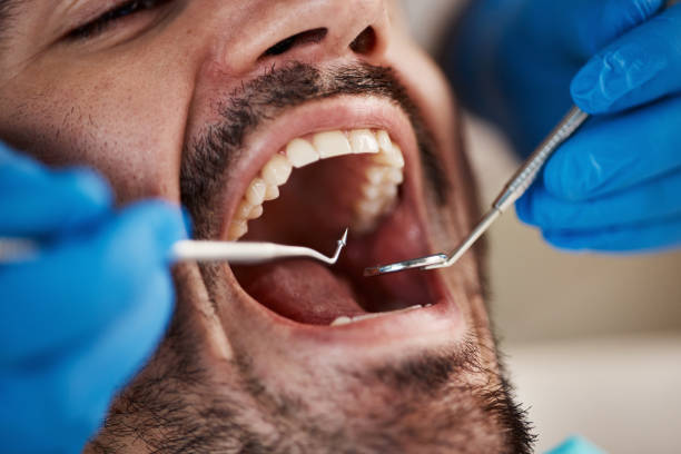 Best Chipped Tooth Repair Near Me  in Forest Hills, MI