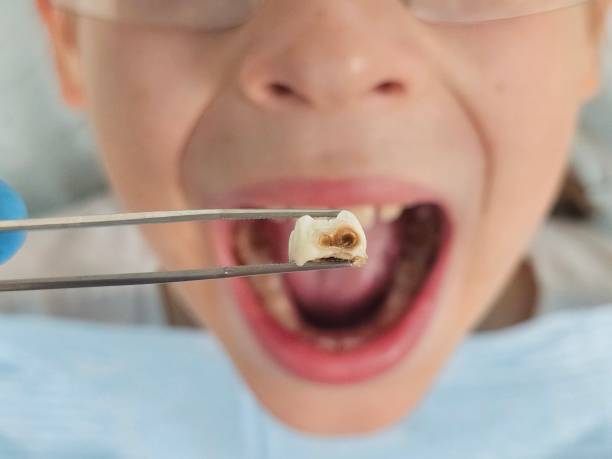 Best Emergency Pediatric Dentist  in Forest Hills, MI